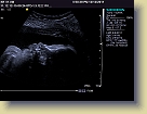 Week32-Siemens-Ultrasound-Dec2011 (7) * 1024 x 768 * (155KB)